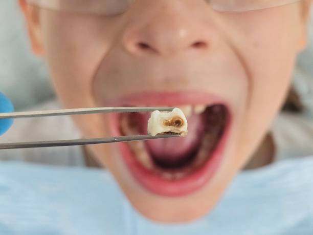 Best Emergency Gum Treatment in Kutztown, PA